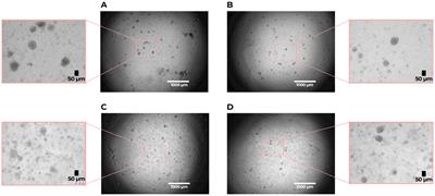 Dysregulated cross-talk between alveolar epithelial cells and stromal cells in idiopathic pulmonary fibrosis reduces epithelial regenerative capacity